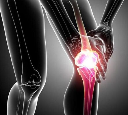 оштећење коленског зглоба артритисом и артрозо